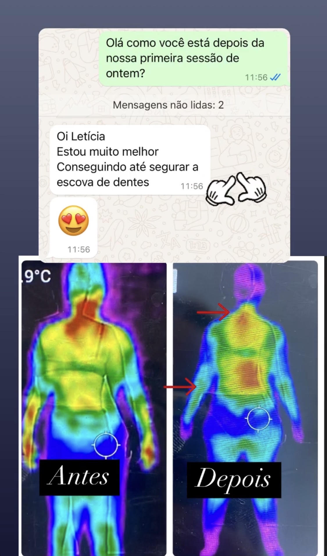 Relato de paciente com acompanhamento termográfico e melhora funcional